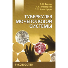 Туберкульоз сечостатевої системи. Керівництво