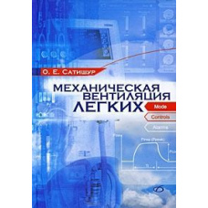 Механічна вентиляція легень