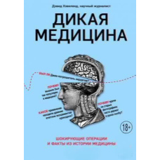 Дика медицина. Шокуючі операції та факти з історії медицини