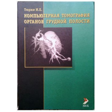 Компьютерная томография органов грудной полости #