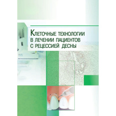 Клітинні технології в лікуванні пацієнтів з рецесією ясен