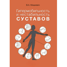 Гіпермобільність і нестабільність суглобів