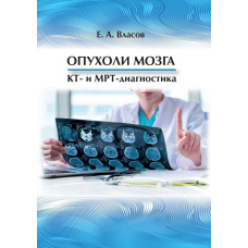 Пухлини мозку. КТ- та МРТ-діагностика
