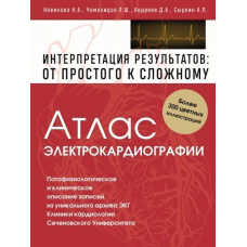 Атлас електрокардіографії. Інтерпретація результатів: від простого до складного
