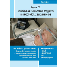 Неінвазивна респіраторна підтримка при розладах дихання уві сні